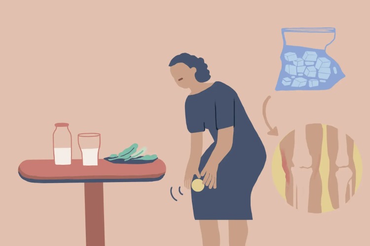 کمبود کلسیم ممکن است باعث پوکی استخوان شود.